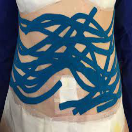 TAPING TERAPÊUTICO E ESTÉTICO - Image 3