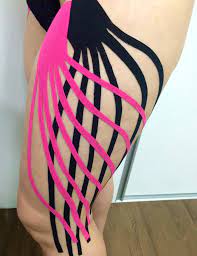 TAPING TERAPÊUTICO E ESTÉTICO - Image 7